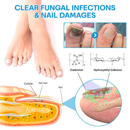 Liascy™ Advance Light FootFix Device