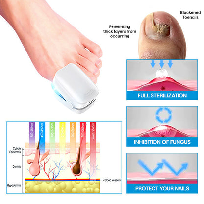 Liascy™ Pure Advance Light FootFix Device