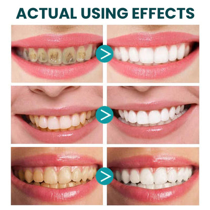 Liascy™ Instant Teeth Whitening Paint