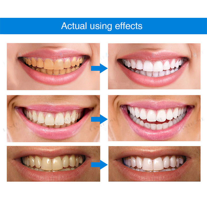 Liascy™ Teeth Whitening Denti Essence