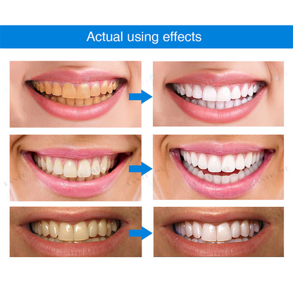 Liascy™ Teeth Whitening Denti Essence