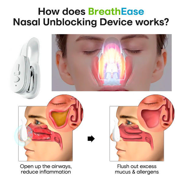 BreathEase Nasal Unblocking Device