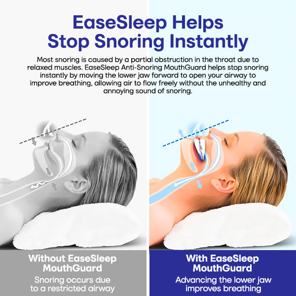 EaseSleep Anti-Snoring MouthGuard