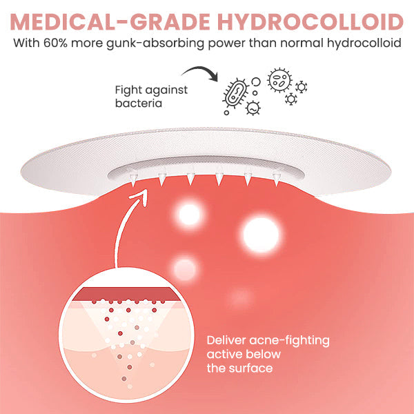 Blusoms™ AcneAtelier Microneedles Patch