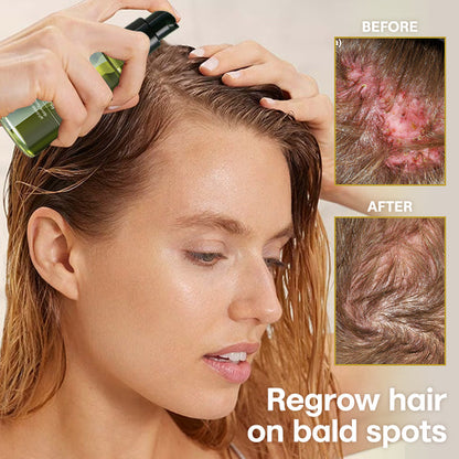 Blusoms™ Olive Hair Scalp-Repair Spray