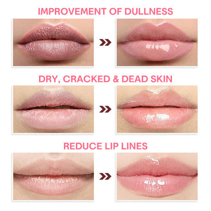 KissChuu Plumps Up Lip Mask