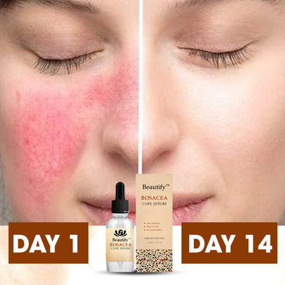 Beautify™ Rosacea Cure Serum