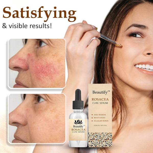 Beautify™ Rosacea Cure Serum