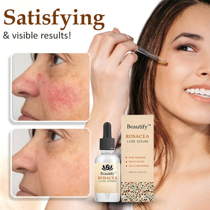 Beautify™ Rosacea Cure Serum